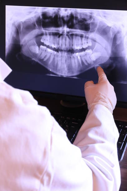 Best Cracked Tooth Emergency Dentist  in Ricardo, TX