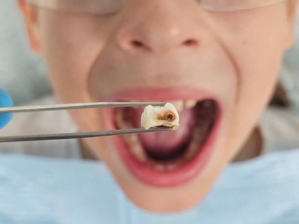Best Tooth Infection Emergency Dentist  in Ricardo, TX